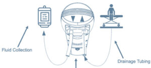 Portable Medical Fluid Pump - Rowad Medical Services